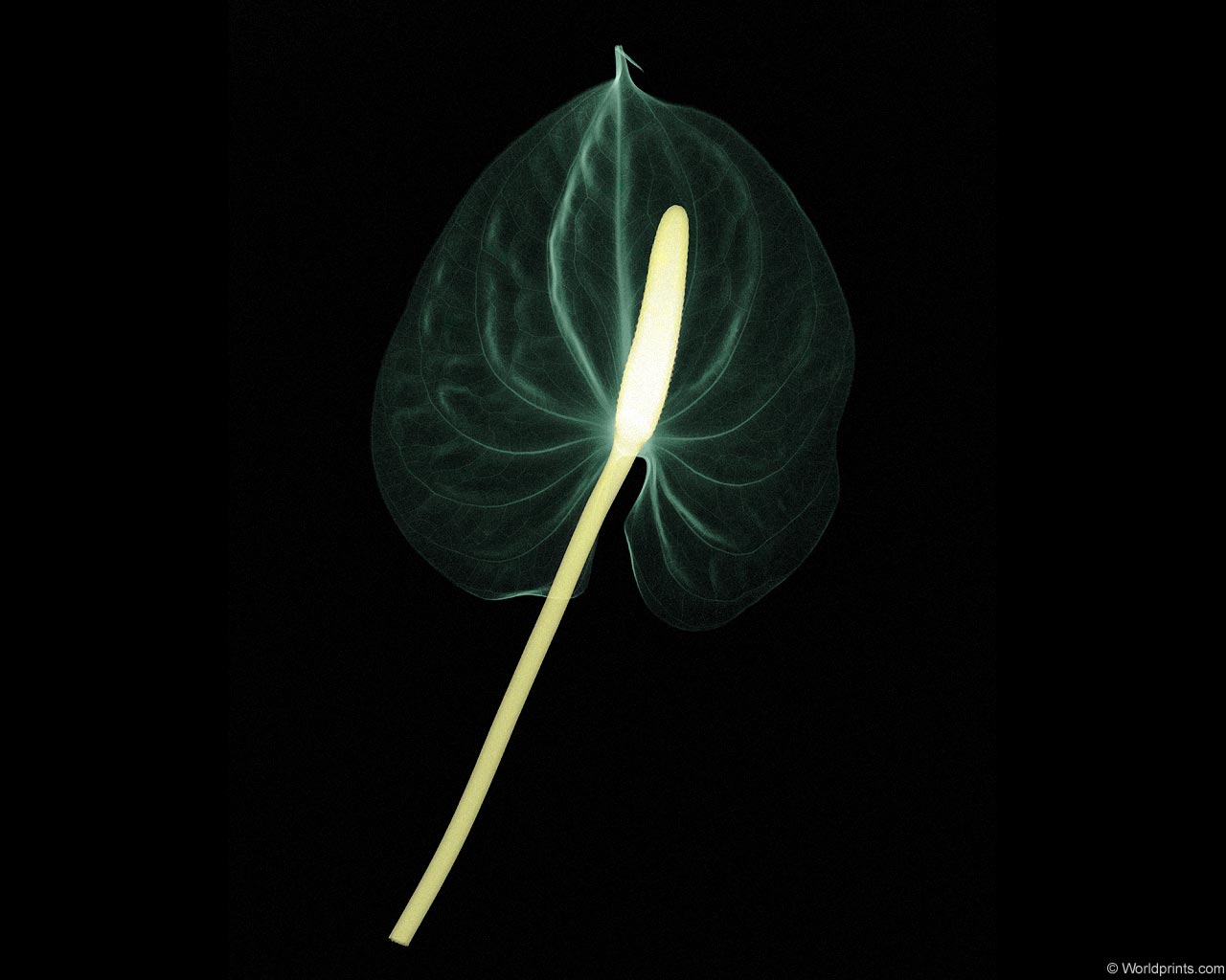  :: X-RAY -  ::  1