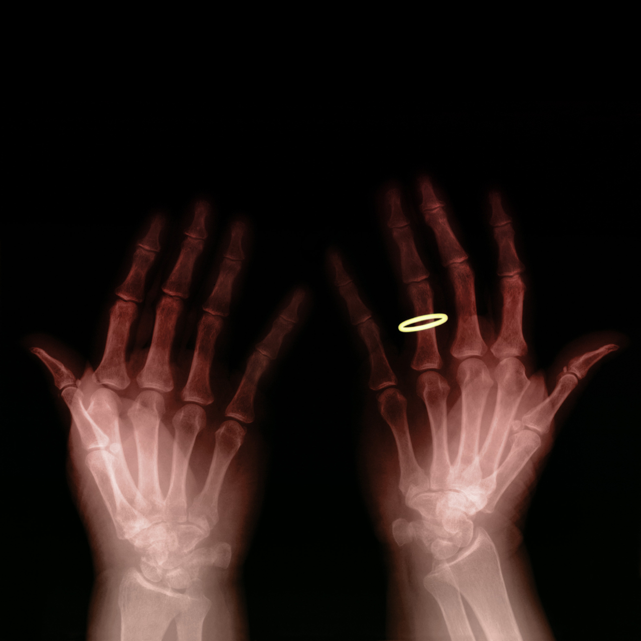  ::  ::  2